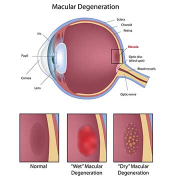 Ophthalmologist in Chesterfield