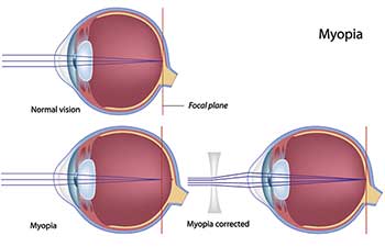 Ophthalmologist in Chesterfield